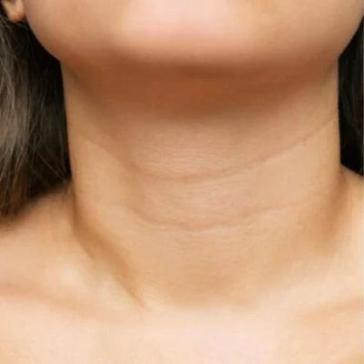 Tech Neck Lines