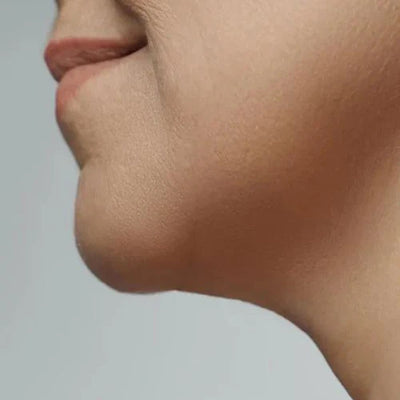 Contour Between Jaw & Neck