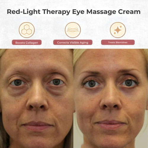 Red Light Therapy Eye Massage Cream (Removes Puffiness & Dark Circles)